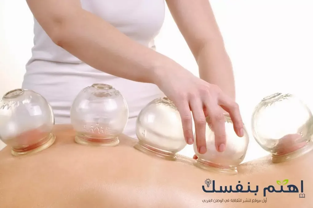 فوائد العلاج بكاسات الهواء - الحجامة الطبية 1 كاسات الهواء للحجامة