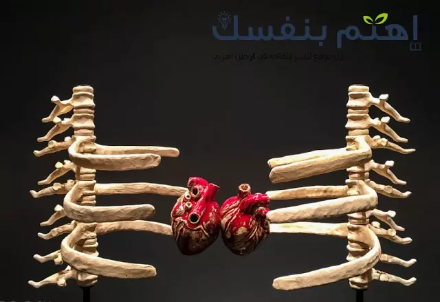 هشاشة العظام