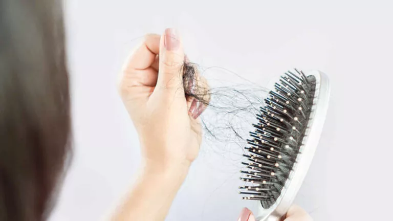مشاكل تساقط الشعر : افضل الحلول المنزلية والطبيعية