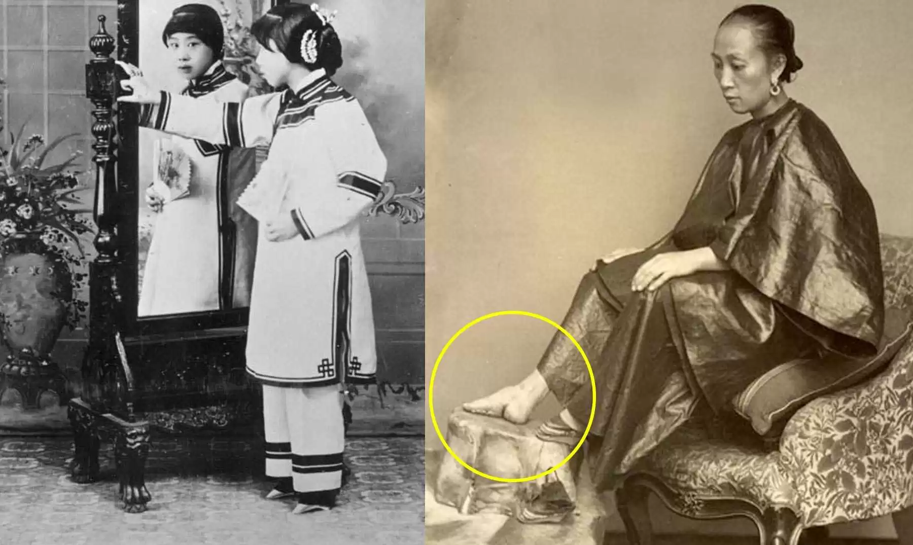 ظاهرة أقدام اللوتس : تقليد قديم ومؤلم تعرضت له النساء في الصين 1 ظاهرة أقدام اللوتس